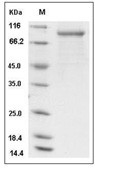 CSF3R/G-CSFR Protein, Human, Recombinant (His)
