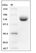 Aminopeptidase N/CD13 Protein, Human, Recombinant (I603M, His)
