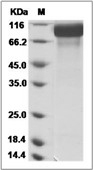 HER2/ERBB2 Protein, Cynomolgus, Recombinant (His)