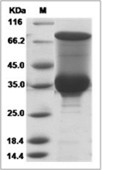 PfLDH Protein, P. falciparum, Recombinant (His)