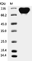 Fibronectin Protein, Human, Recombinant (aa 607-1265, His)