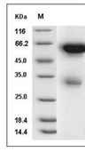 Legumain Protein, Mouse, Recombinant (His)