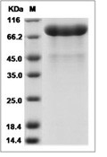 PAM Protein, Human, Recombinant (His)