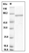Acid sphingomyelinase/SMPD1 Protein, Mouse, Recombinant (His)