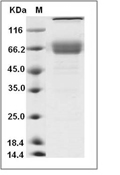IL-10R alpha/IL-10RA Protein, Mouse, Recombinant (hFc)