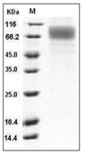 SR-BI/SCARB1 Protein, Human, Recombinant (His)