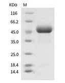 GLA/alpha-Galactosidase A Protein, Human, Recombinant (His)