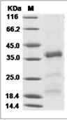 Cerberus 1/CER1 Protein, Human, Recombinant (His)