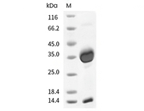 FCGRT & B2M Heterodimer Protein, Cynomolgus, Recombinant (His)