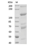 Complement C3 Protein, Cynomolgus, Recombinant (His)