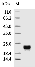 VEGFC Protein, Human, Recombinant (His)