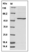 PAH Protein, Human, Recombinant (415 Asn/Asp, His)