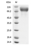 IL-2RG Protein, Human, Recombinant (hFc)