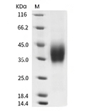 CD16/FCGR3 Protein, Mouse, Recombinant (aa 32-215, His)