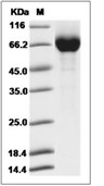 Influenza A H7N9 (A/Anhui/1/2013) Neuraminidase/NA Protein (His)