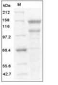 LDLR Protein, Human, Recombinant (His)