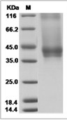 IL-7R alpha/CD127 Protein, Cynomolgus, Recombinant (His)