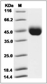 Influenza A H7N9 (A/Anhui/1/2013) Hemagglutinin/HA1 Protein (His)