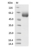 Influenza A H1N1 (A/California/04/2009) Hemagglutinin/HA Protein