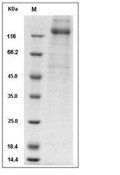Human cytomegalovirus (HCMV) Glycoprotein B/gB Protein (His)