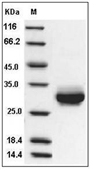 C-Reactive Protein Protein, Rat, Recombinant (His)