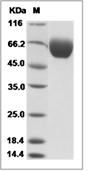 IL-1RAP/IL-1RAcP Protein, Mouse, Recombinant (His)