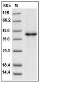SDF-1/CXCL12 Protein, Human, Recombinant (hFc)
