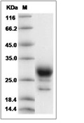 Prostaglandin D2 Synthase Protein, Human, Recombinant (His)