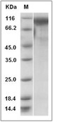 Osteoactivin/GPNMB Protein, Mouse, Recombinant (His)