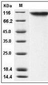 E-Selectin/CD62E Protein, Human, Recombinant (His)