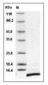 SDF-1 beta/CXCL12 Protein, Human, Recombinant