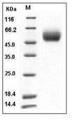 FGFR1 Protein, Human, Recombinant (His)