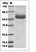 Zika virus (ZIKV) (strain Zika SPH2015) ZIKV-NS1 protein (His)