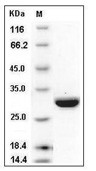 Carbonic Anhydrase 2 Protein, Human, Recombinant (His)