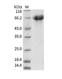 Influenza A H3N2 (A/Aichi/2/1968) Hemagglutinin/HA Protein (HA1+HA2, uncleaved) (His)