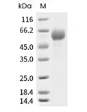 ROR1 Protein, Human, Recombinant (His)