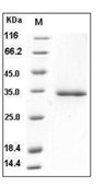 Ficolin 1/FCN1 Protein, Human, Recombinant (His)