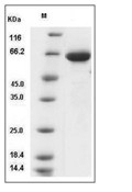 Alpha-fetoprotein Protein, Human, Recombinant (His)