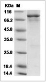 EGFR Protein, Human, Recombinant (aa 668-1210, His & GST)