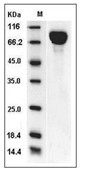 gp130/IL6ST Protein, Mouse, Recombinant (His)
