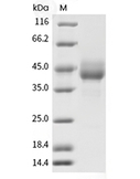 TIGIT Protein, Human, Recombinant (hFc)