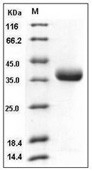 Prolactin Receptor Protein, Human, Recombinant (His)