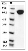 c-Kit/CD117 Protein, Mouse, Recombinant (His)