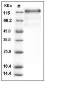 VEGFR3/FLT4 Protein, Human, Recombinant (His)