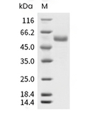 CD39 Protein, Human, Recombinant (His)
