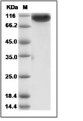 MERS-CoV Spike/S1 Protein (aa 1-725, His)
