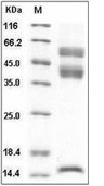 Latent TGF beta 1 Protein, Human, Recombinant (His)