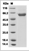 Influenza A H10N8 (A/Jiangxi-Donghu/346/2013) Hemagglutinin/HA Protein (His)