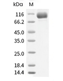 FAP Protein, Human, Recombinant (His)