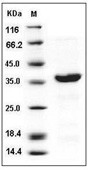 EMAP-II/AIMP1 Protein, Human, Recombinant (His)